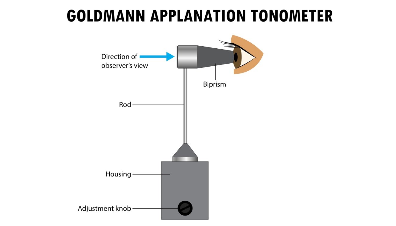 Applanation Tonometers