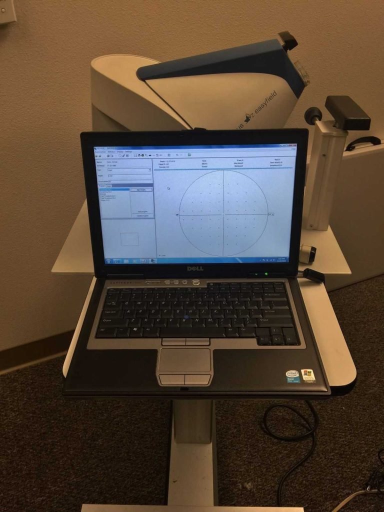 Oculus EasyField Perimeter Visual Field Analyzer Nava Ophthalmic