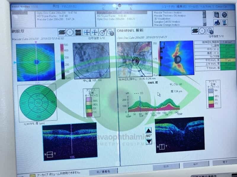 CARL ZEISS Cirrus HD-OCT 4000