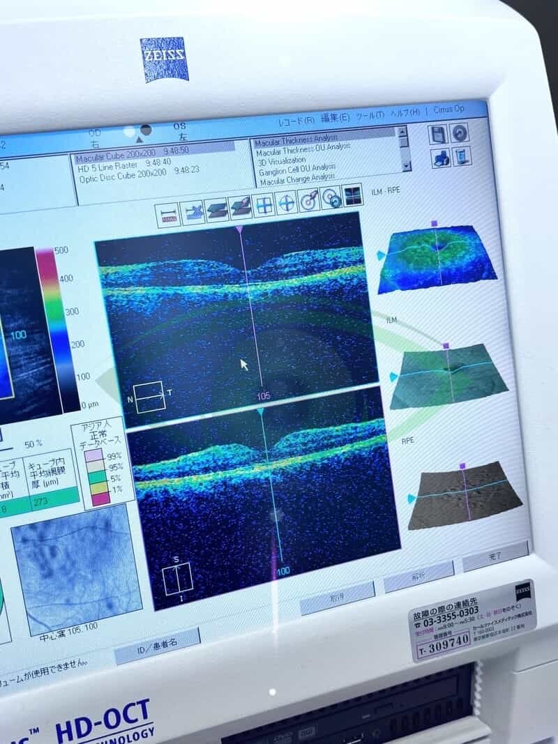 CARL ZEISS Cirrus HD-OCT 4000