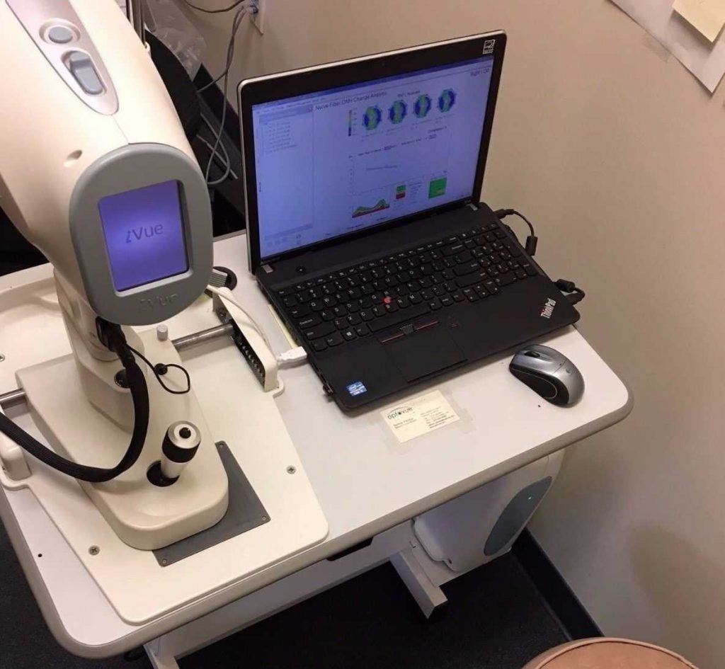 OPTOVUE iVue OCT Retinal Camera - Nava Ophthalmic