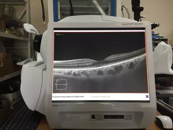 CARL ZEISS Cirrus HD-OCT 5000