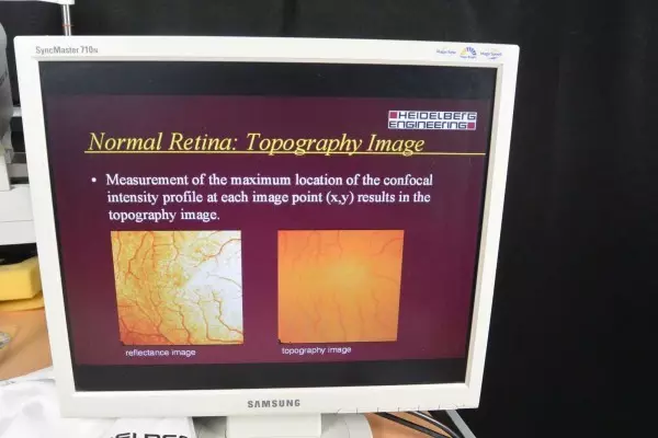 Heidelberg Retina Tomograaf 2 HRT II