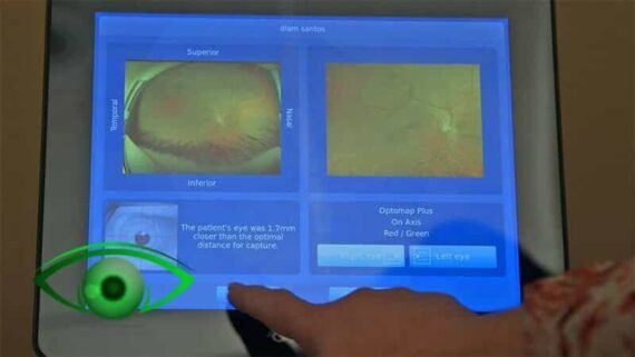 Used Optos Daytona Digital Retinal Scanner