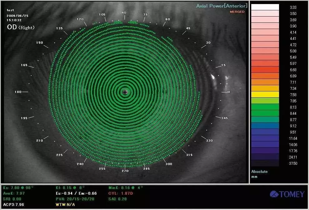 Tomey TMS-4 Corneal Topographer System