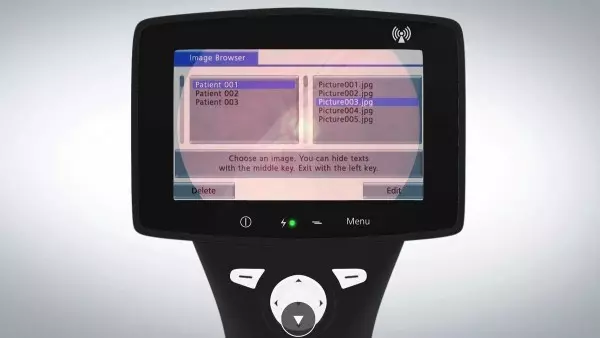 ZEISS VISUSCOUT 100 – Handheld Fundus Camera a