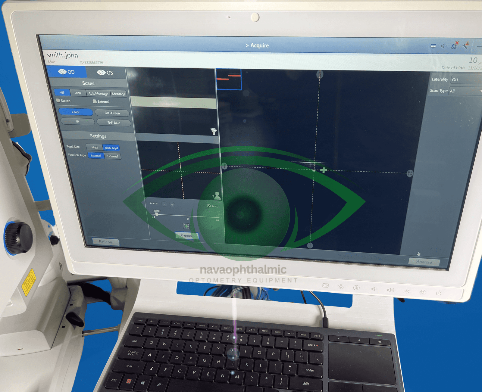 Zeiss Clarus 500 Ultra-widefield (UWF) Imaging System
