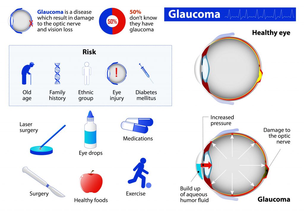 leading causes of Glaucoma
