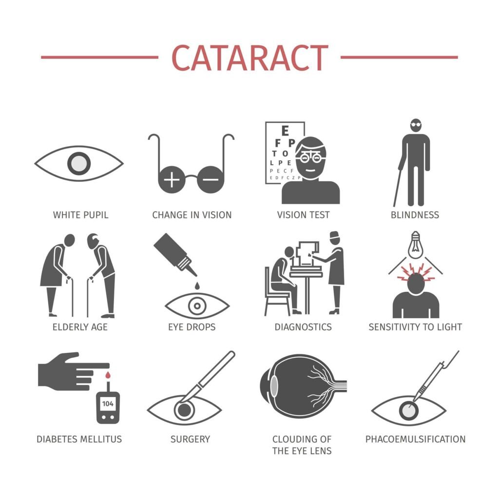 cataracts