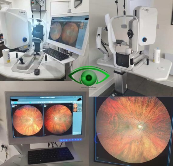 Zeiss Clarus 700 Ultra widefield Fundus Imaging